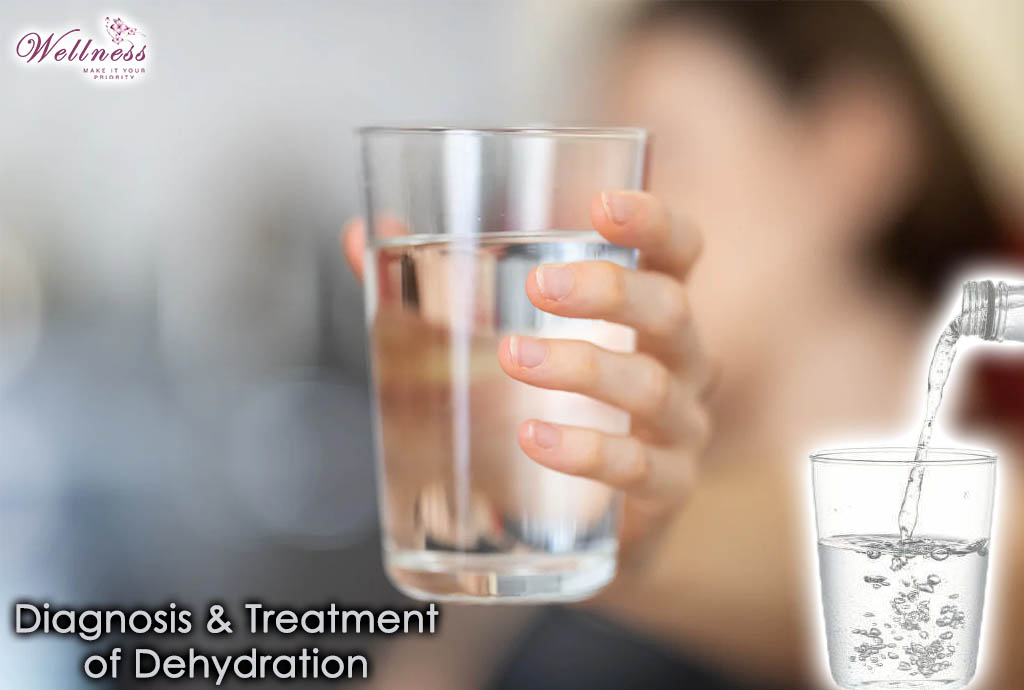 Diagnosis and Treatments of Dehydration