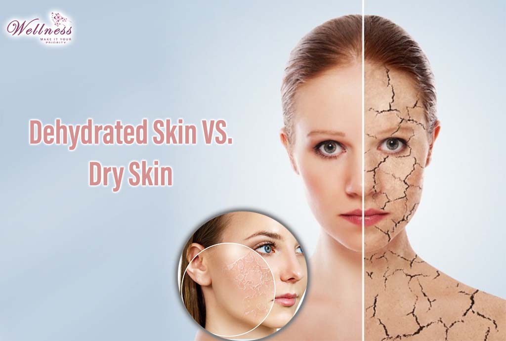 Dehydrated Skin vs Dry Skin - Dehydrated Skin: How does it look and what are the treatments? 