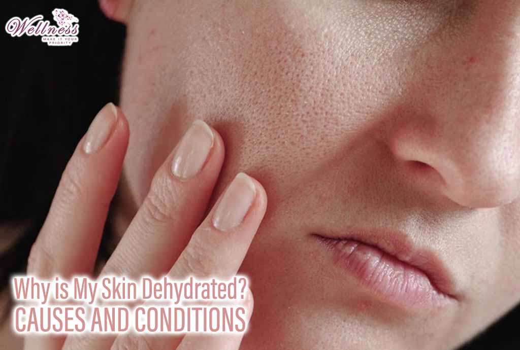 Why is My Skin Dehydrated: Causes and Conditions
